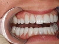 Konig Center for Cosmetic & Comprehensive Dentistry smile photos